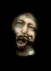 歯医者さんに飾ってある絵 虫歯の末路 が怖い 彫刻へのボケ ボケて Bokete