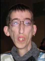 アバダケダブラをギリ耐えたハリー ポッター 15年06月21日の人物のボケ ボケて Bokete