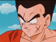 子供の頃ルフィの真似して顔に傷を入れたことを後悔 13年11月14日のイラストのボケ ボケて Bokete